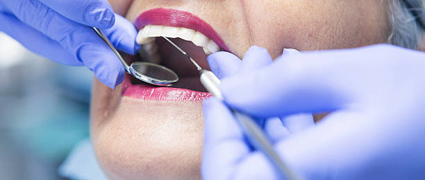Best Emergency Broken Tooth Repair in Mmerce City, CO